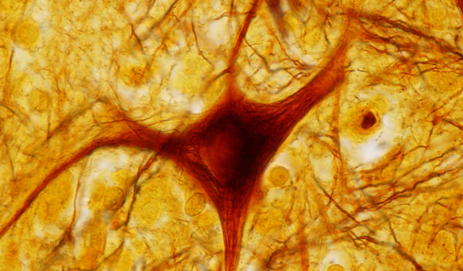 Larger neuron