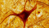 Mini neuron